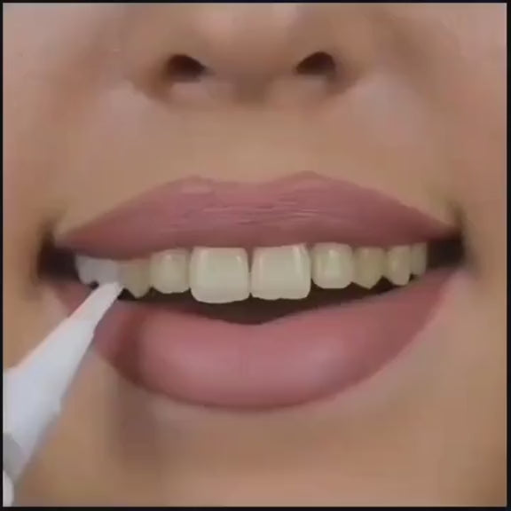 BLANQUEADOR DENTAL EN GEL